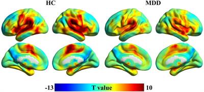 Abnormal Global Functional Connectivity Patterns in Medication-Free Major Depressive Disorder